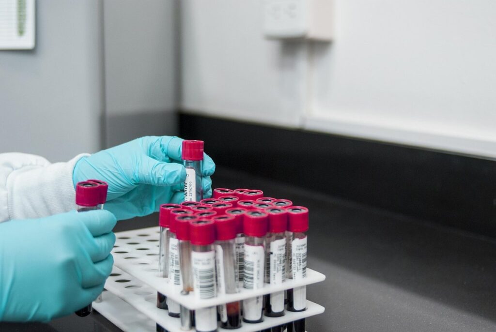 blood tests for dementia
